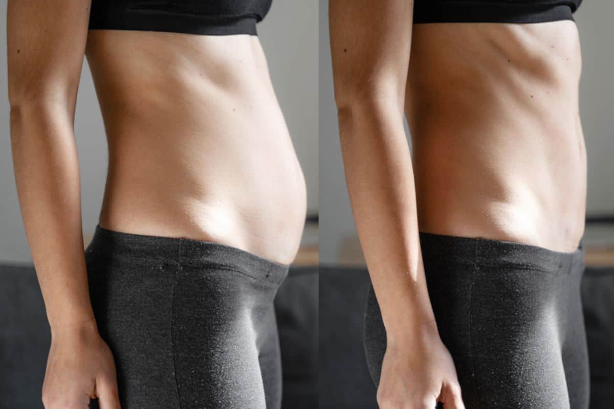 Post-Pregnancy: What Happens to Your Abdominal Muscles After Birth Basildon