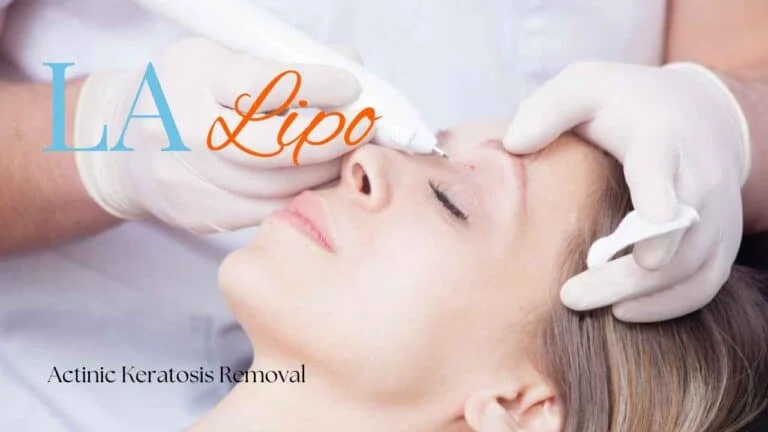 Woman receiving Actinic Keratosis Removal Treatment Basildon