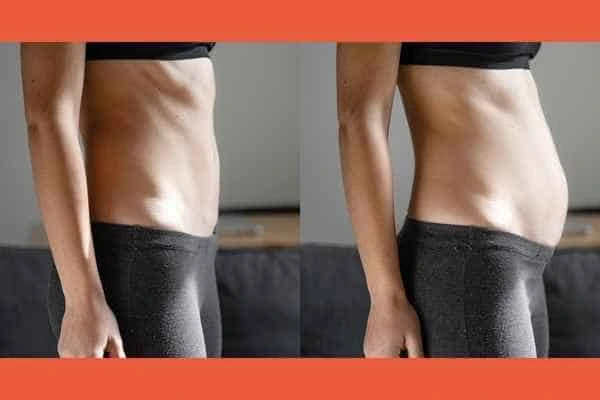 LA-EMS Body Sculpting results Basildon