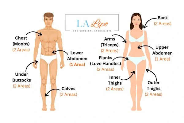 LA LIPO Cryolipolysis Areas Basildon