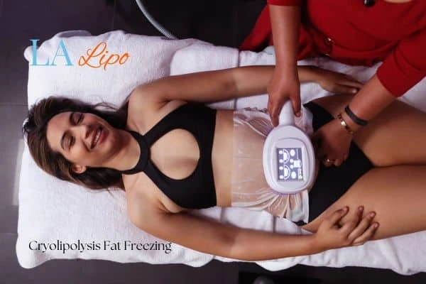 woman getting cryolipolysis Basildon