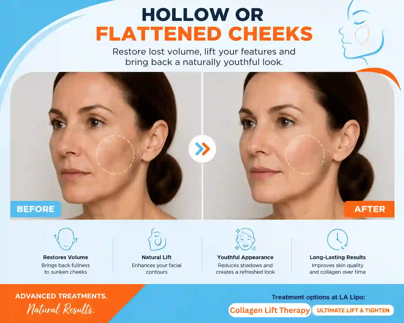 Sign #4: Hollow or Flattened Cheeks Basildon