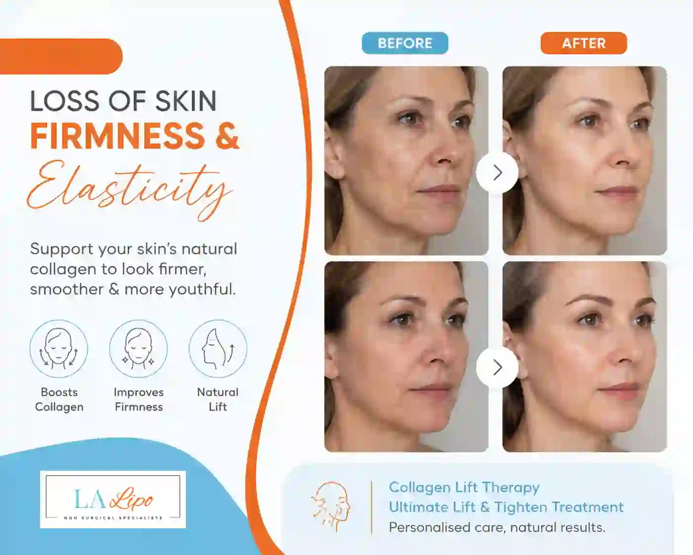 Sign #7: Loss of Skin Firmness and Elasticity Basildon