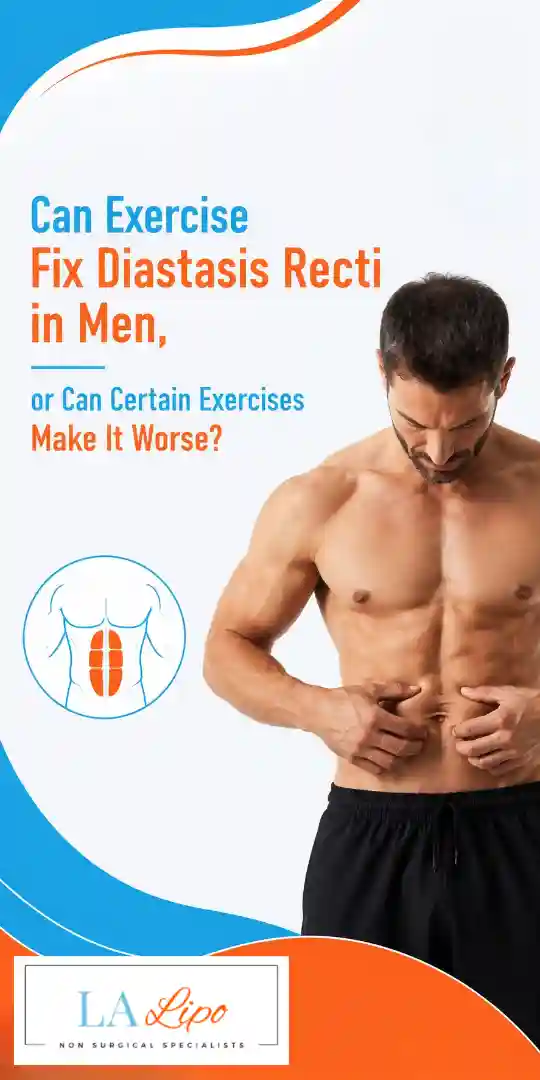 Can Exercise Fix Diastasis Recti in Men, or Can Certain Exercises Make It Worse Basildon?